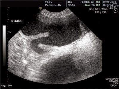 Canine pyometra: Early recognition and diagnosis