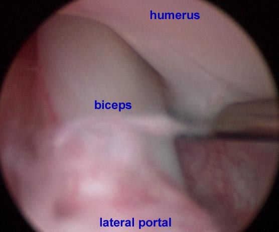 veterinary-Diagnosing-forelimb-lameness-15.jpg