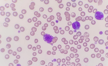 Mast cells under a microscope