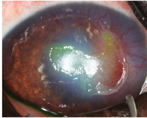 Image Quiz: Can you name these ophthalmic conditions? (sponsored by Nationwide)