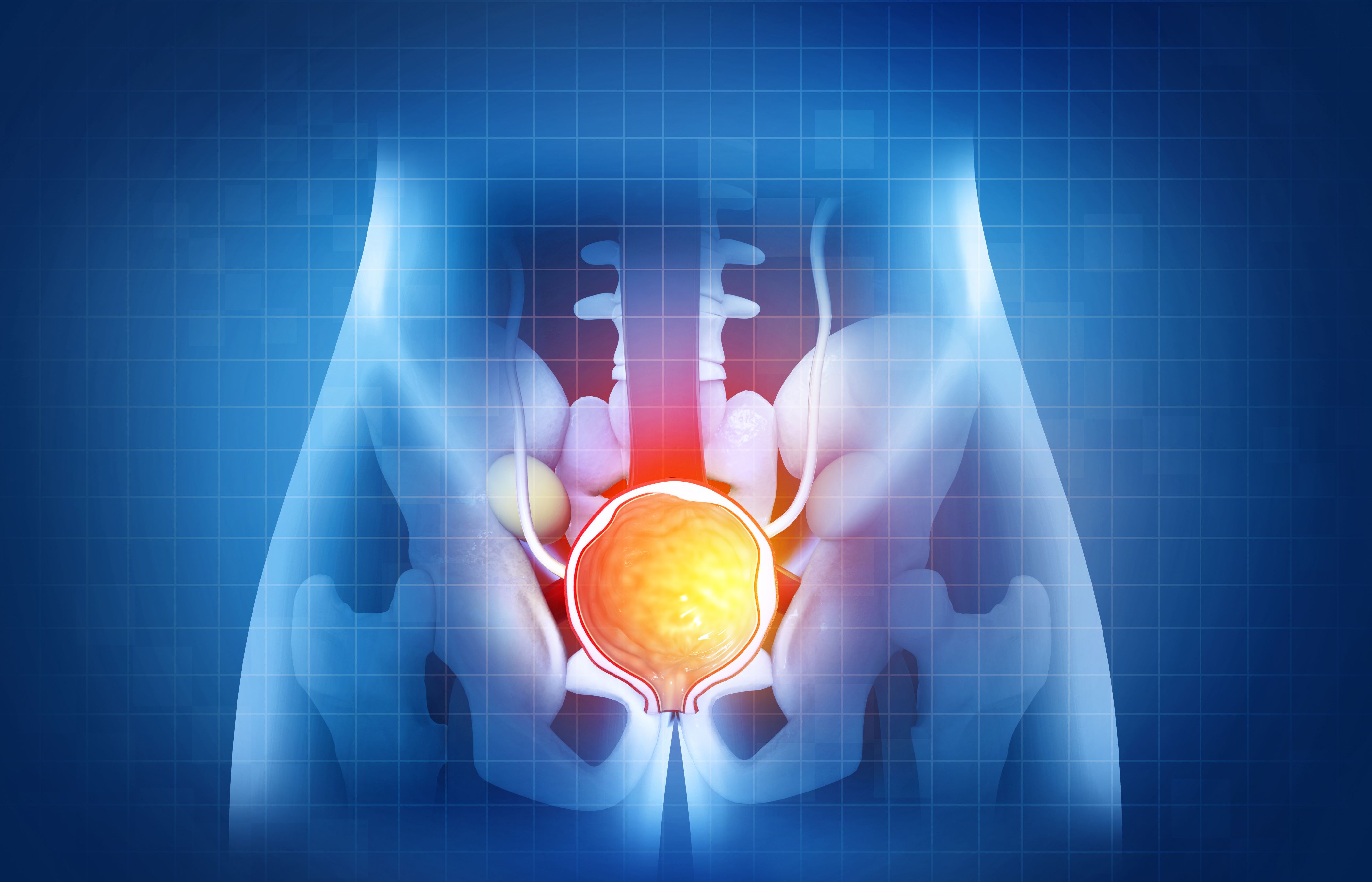 Benign Prostatic Hyperplasia