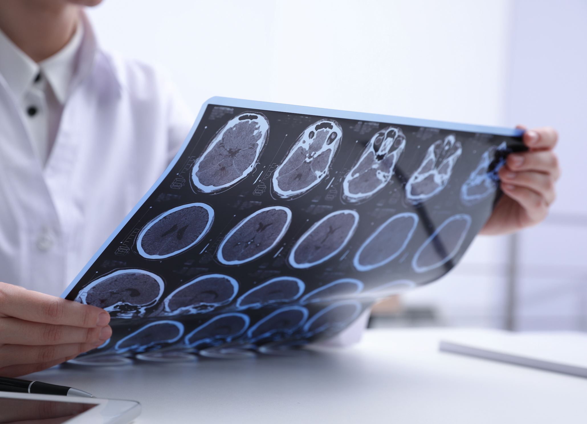 The Educated Patient Podcast: Father and Son Discuss Progress, Hope and Life With Multiple Sclerosis