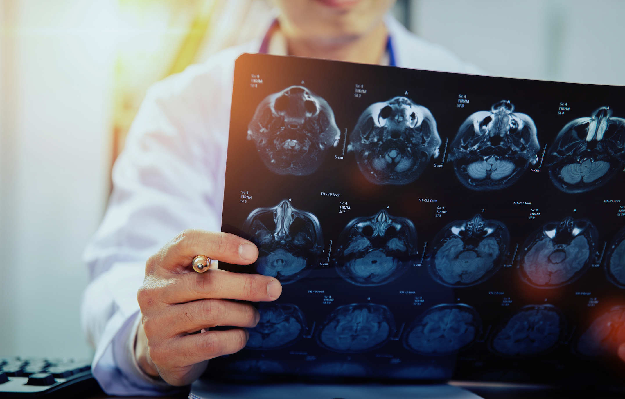 What One LGS Mom Wants Every Caregiver to Know