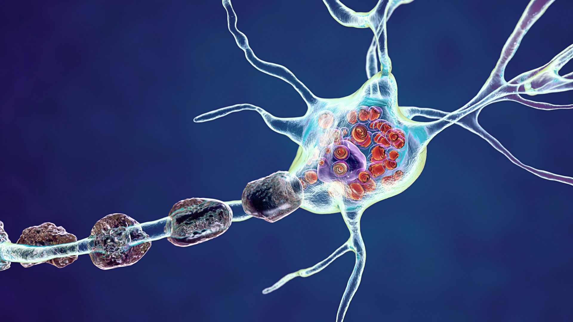 Lysosomal Storage Disorders