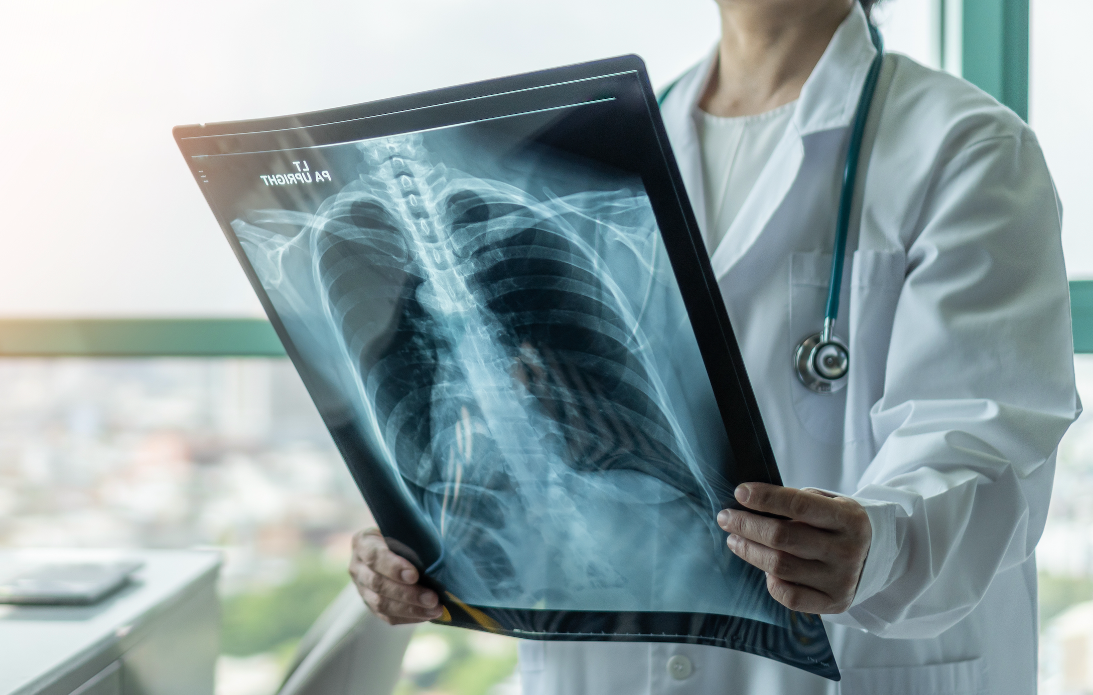 Helping Patients With COPD Breathe Easier Across the Country, with Amit Mahajan, M.D.