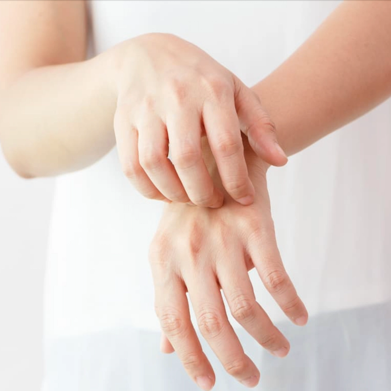 FDA Approves First-Ever Treatment for Chronic Hand Eczema in Adults