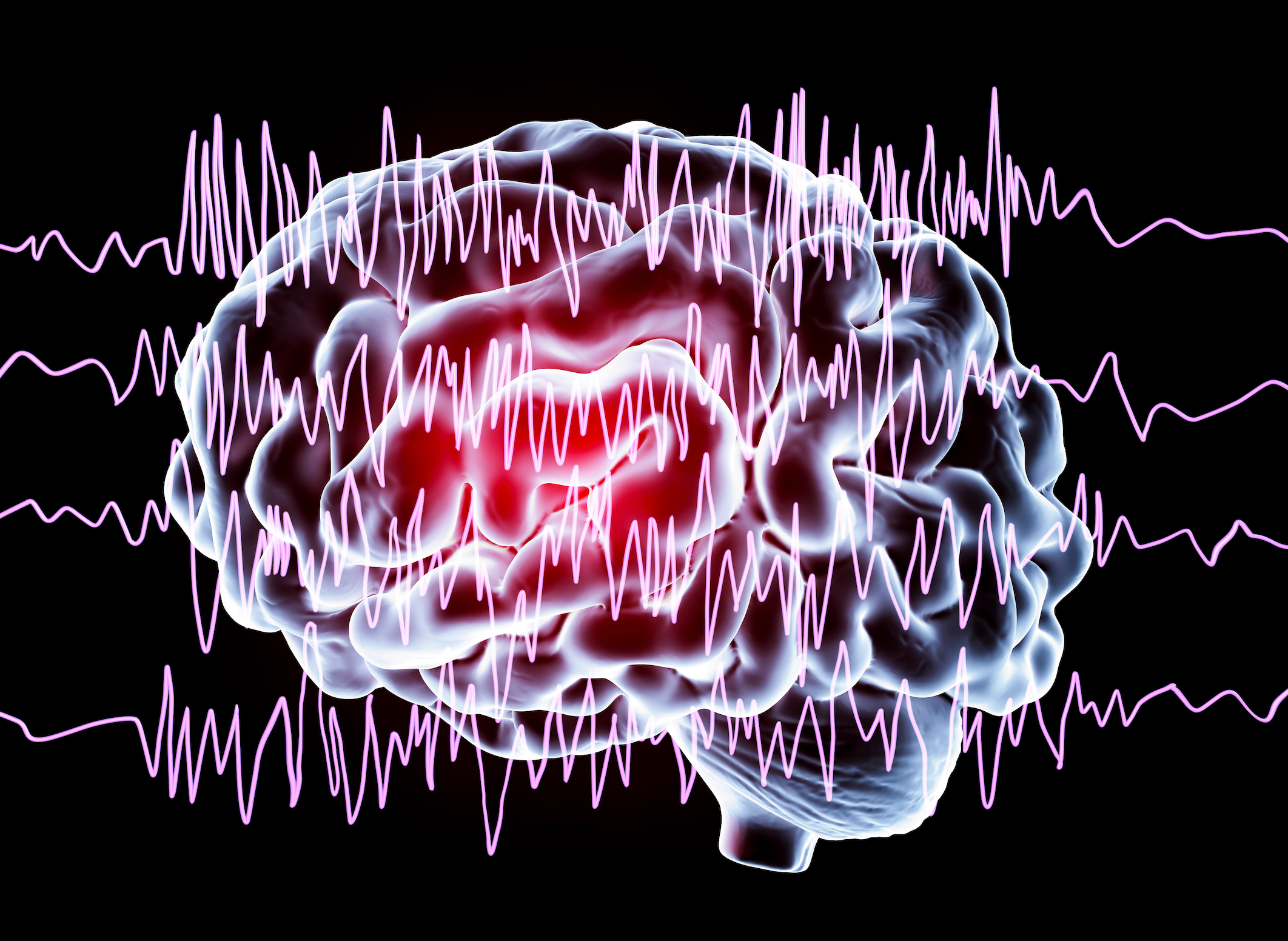 Sleep, Stress and Seizure Control: Key Advice From a Leading Epilepsy Expert