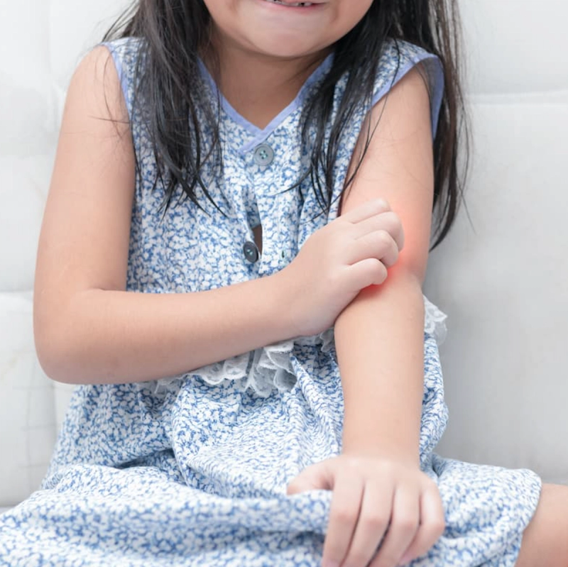 Anne Marie Singh, M.D., Sets the Record Straight on Eczema Triggers