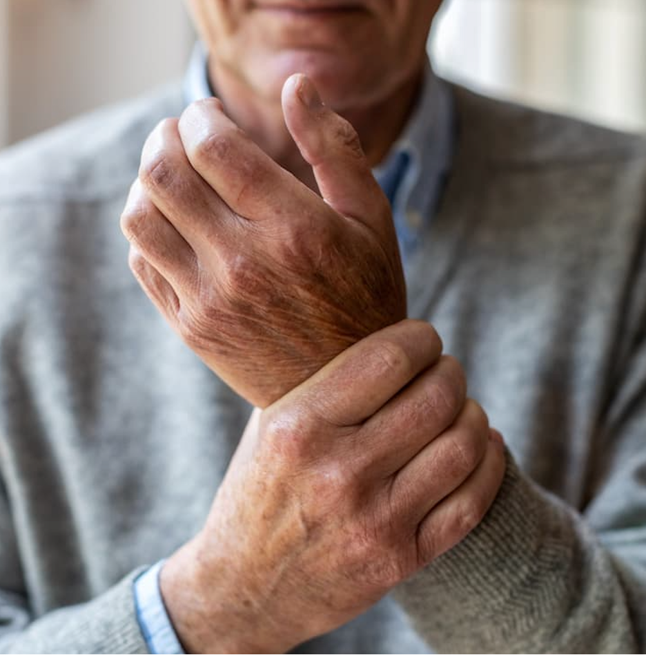 Ejim Mark, M.D., Discusses Key Research on PsA and New Drug Zasocitinib