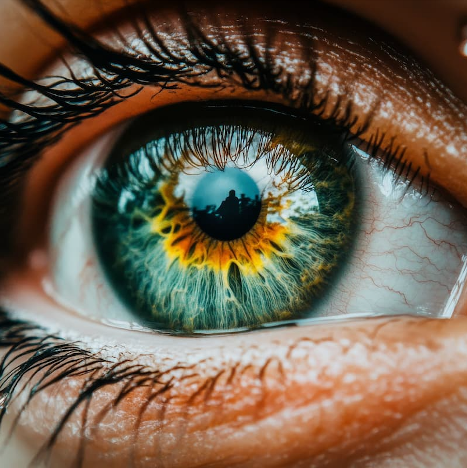 Test Your Uveitis IQ: Quiz Yourself on Eye Health