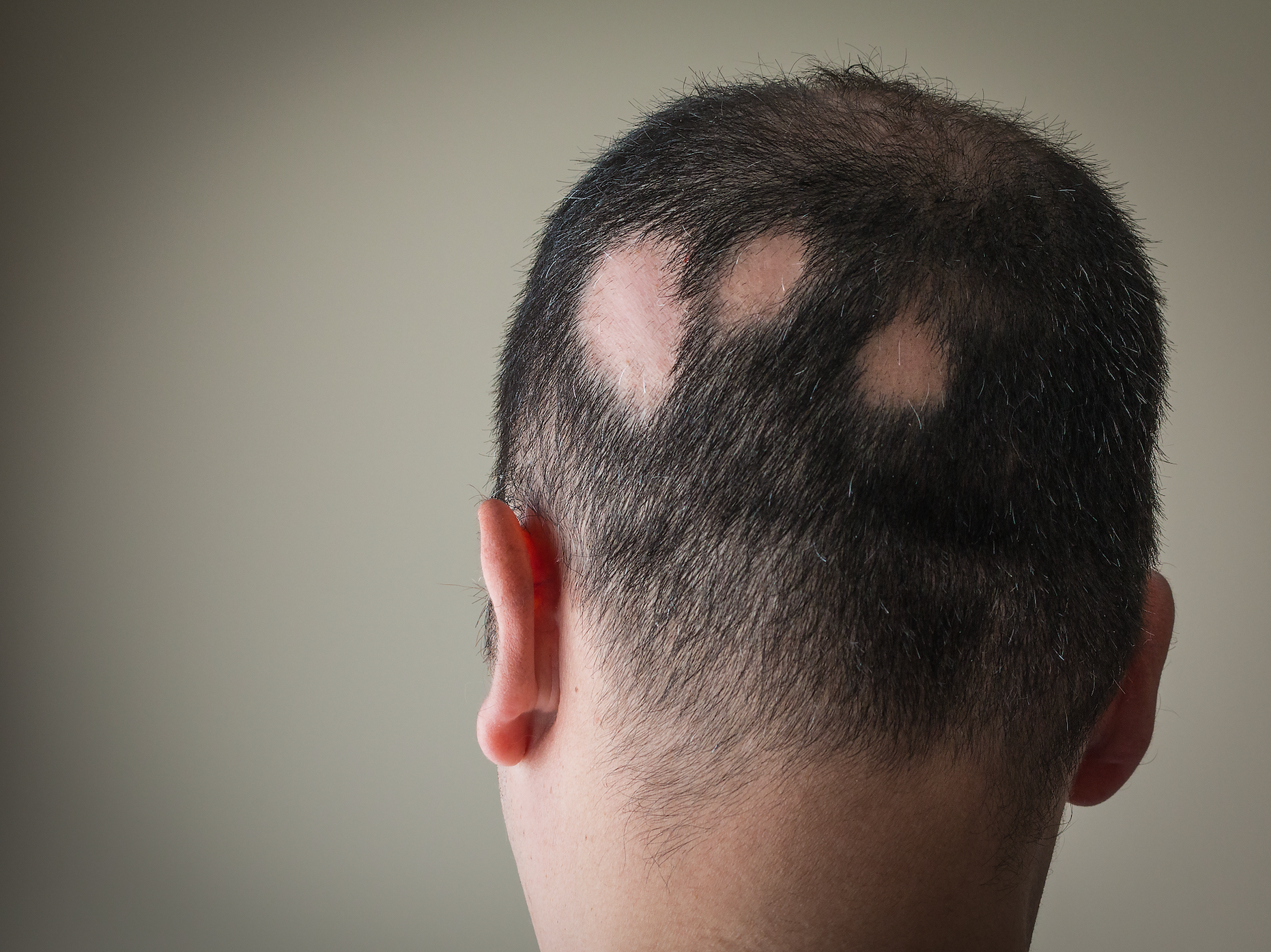 "Regrowth Restyled": A New Campaign Says Self-Expression Doesn't Have to Wait 