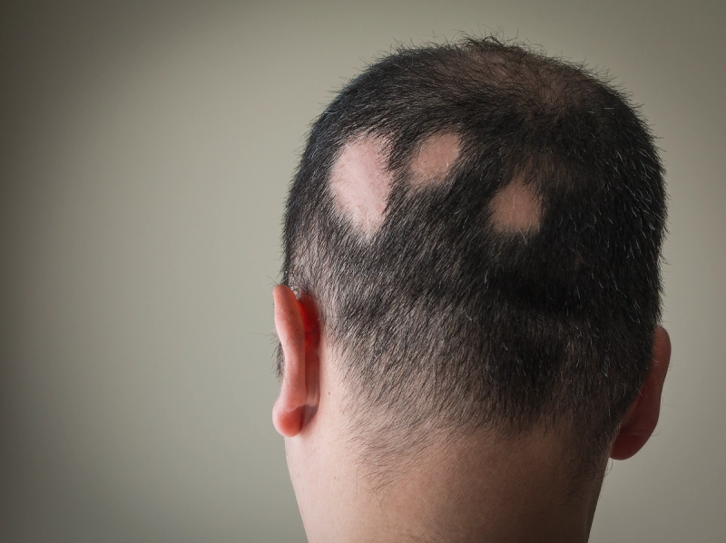 "Regrowth Restyled": A New Campaign Says Self-Expression Doesn't Have to Wait 