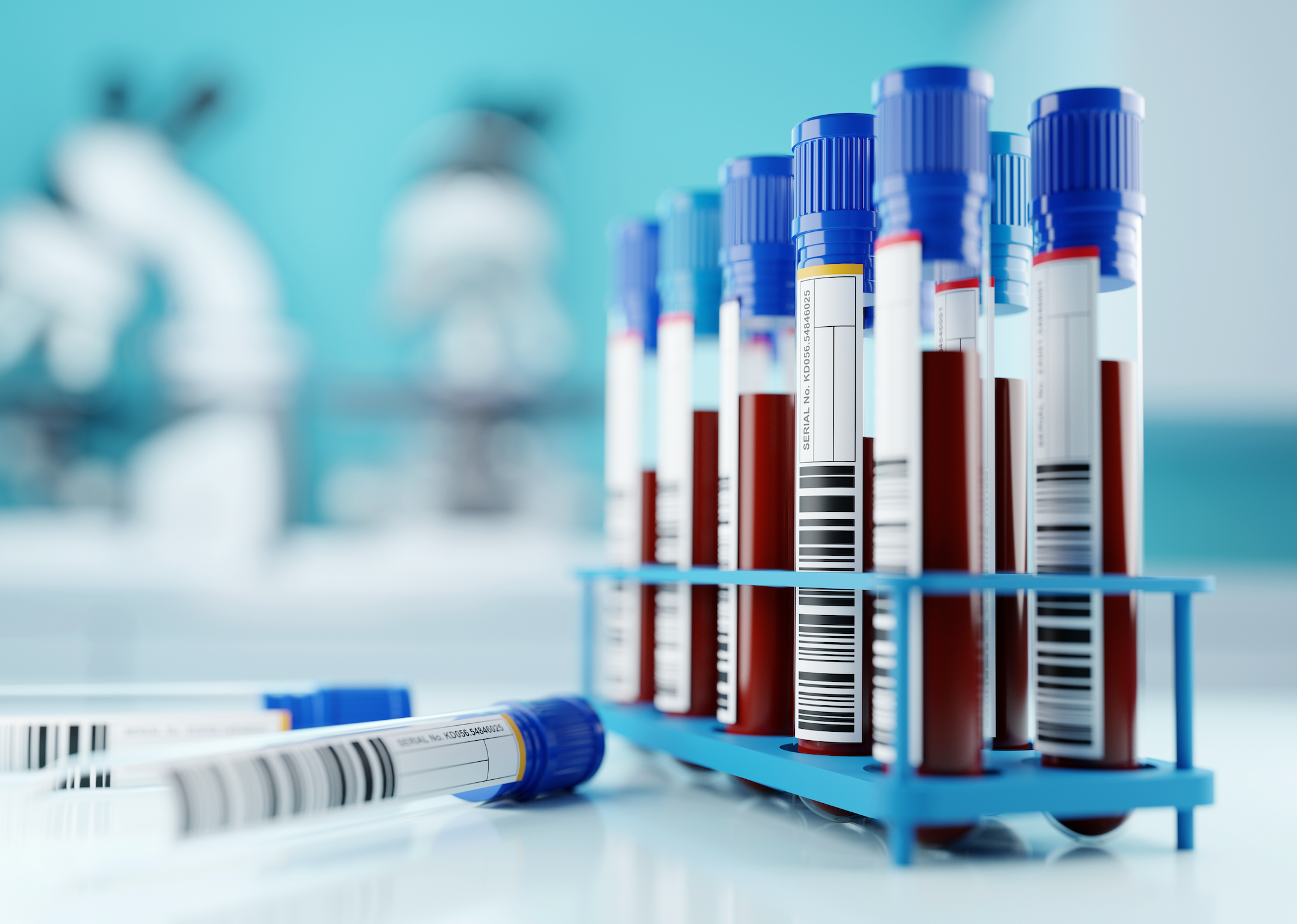 Patients Show Strong Interest in Alzheimer’s Blood Tests