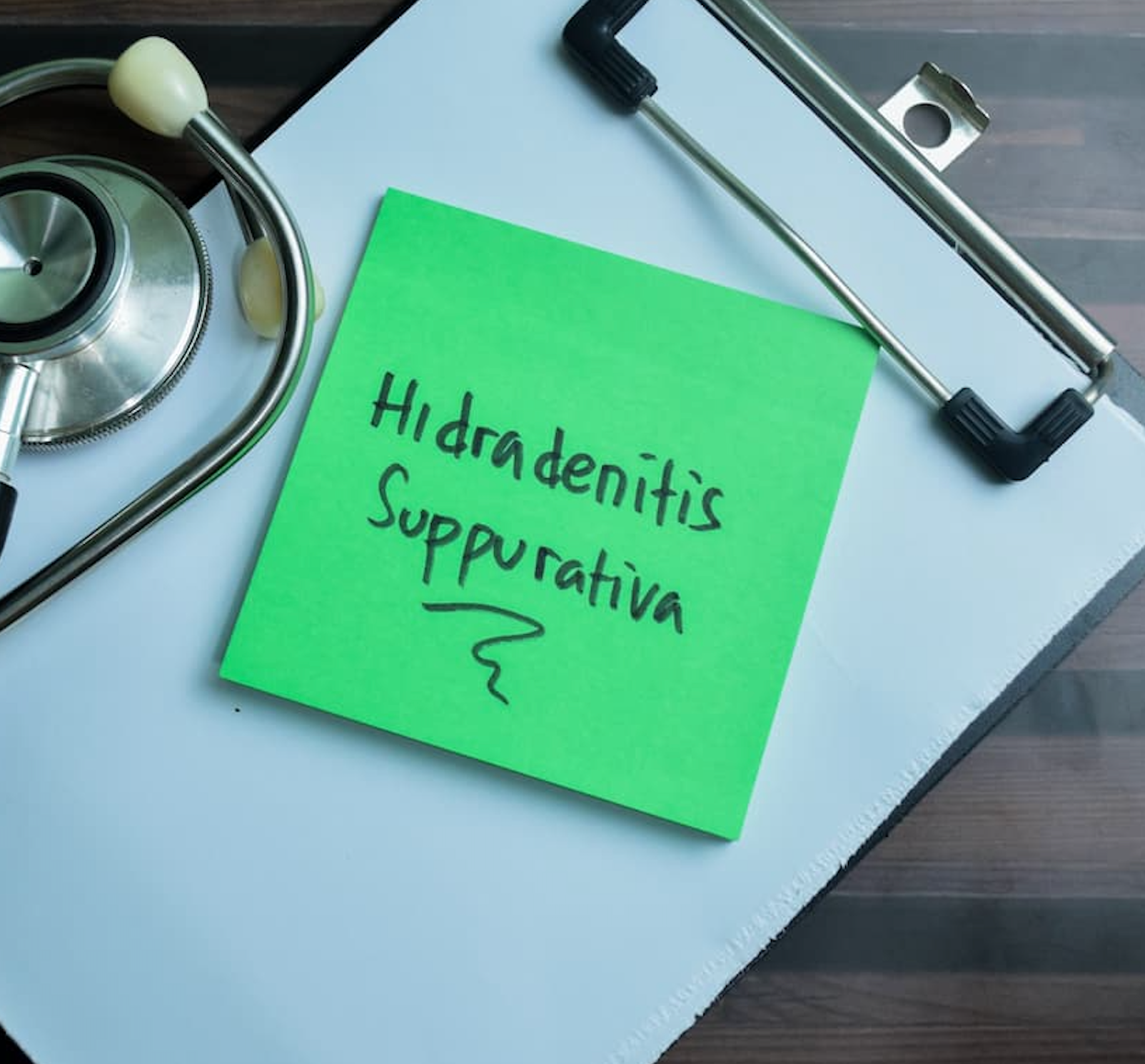 HS Isn’t Just Skin Deep: How Jasmine Manages Life With the Condition