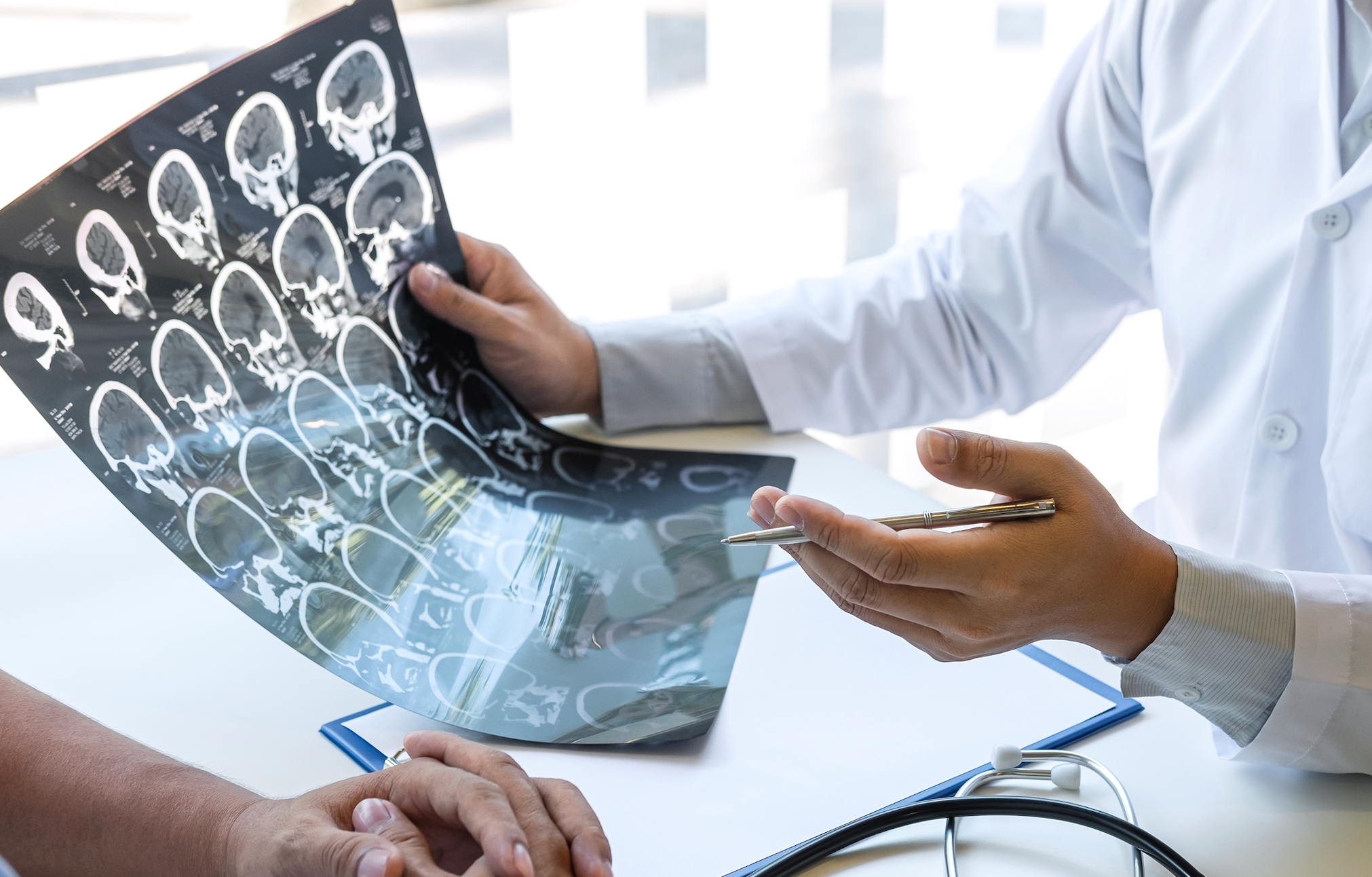 Don’t Wait — Act FAST: Expert Q&A on Stroke Symptoms and Prevention