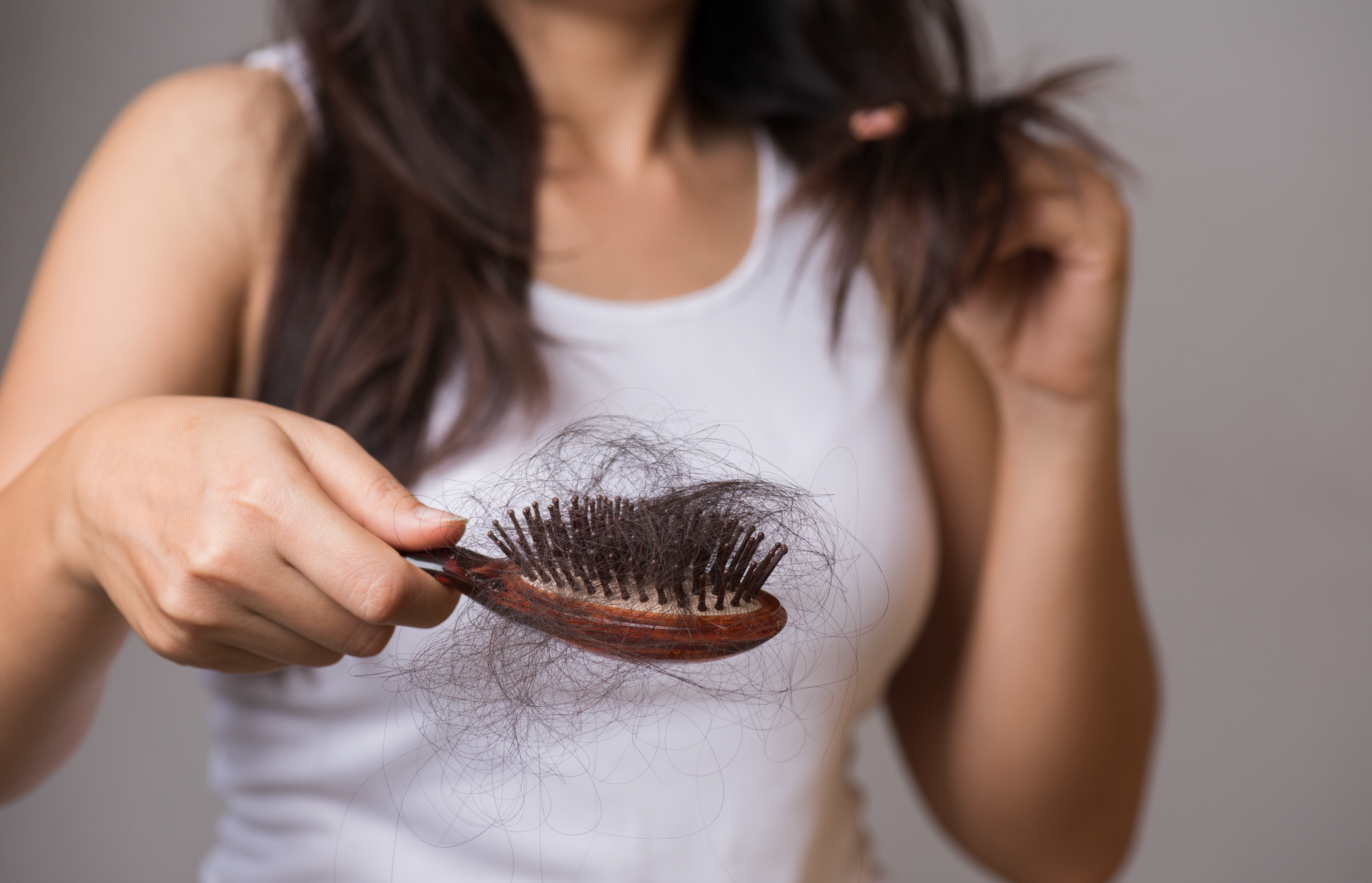 A 50-Year Search for an Alopecia Treatment That Finally Worked
