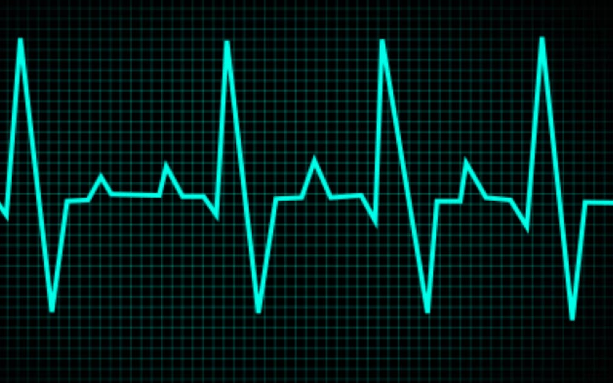 Think You Know AFib? Take the Quiz!