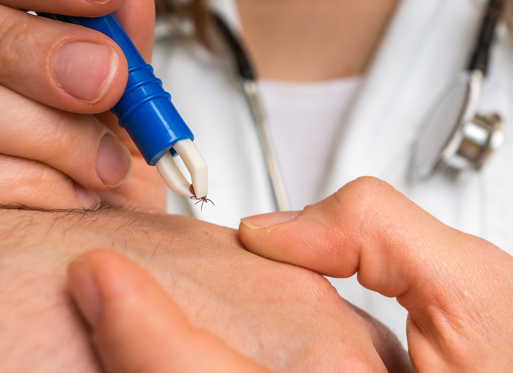 Lyme Disease Awareness: Prevention and Early Detection Matter