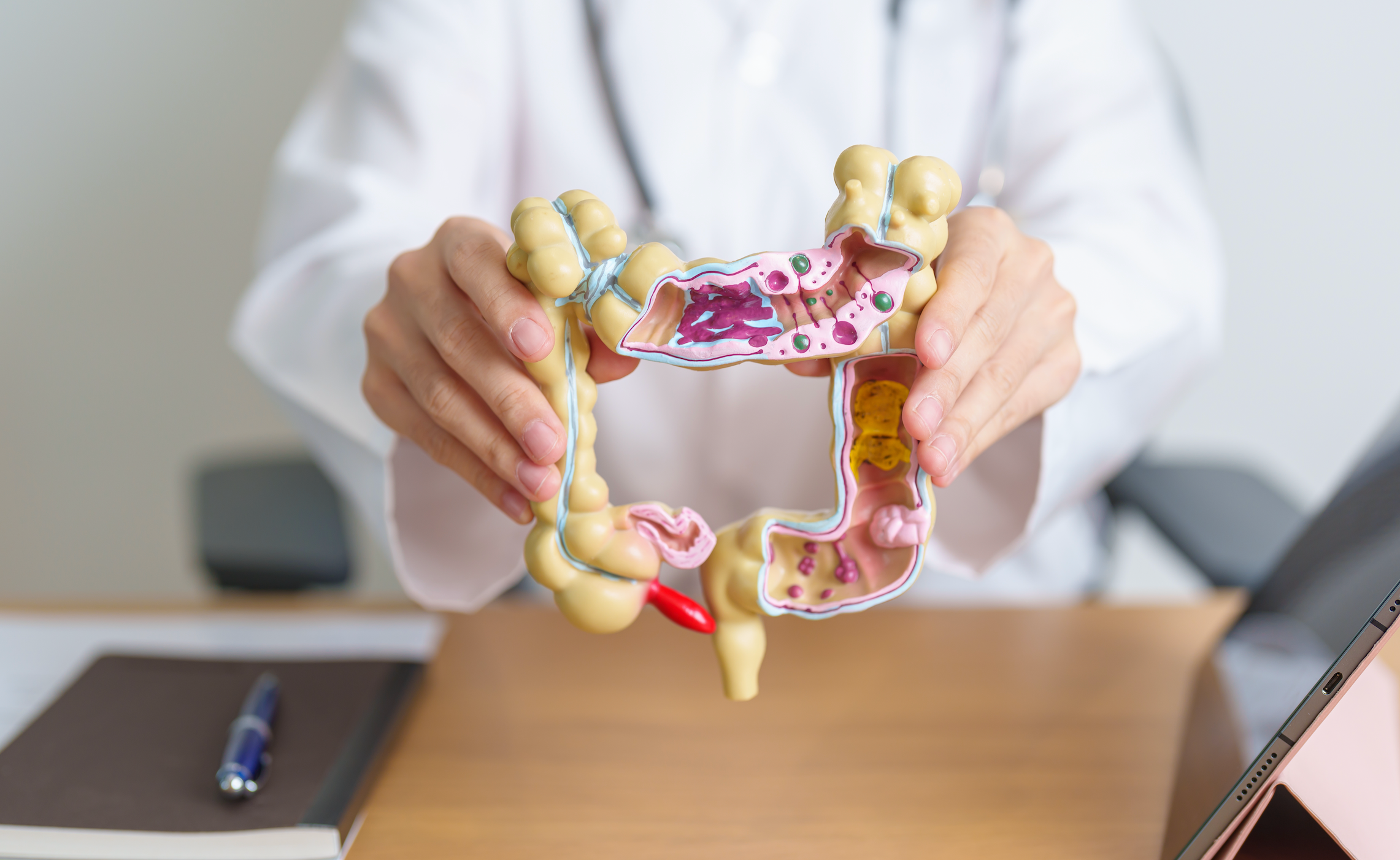 At-Home Screening Gets More Patients Tested for Colon Cancer