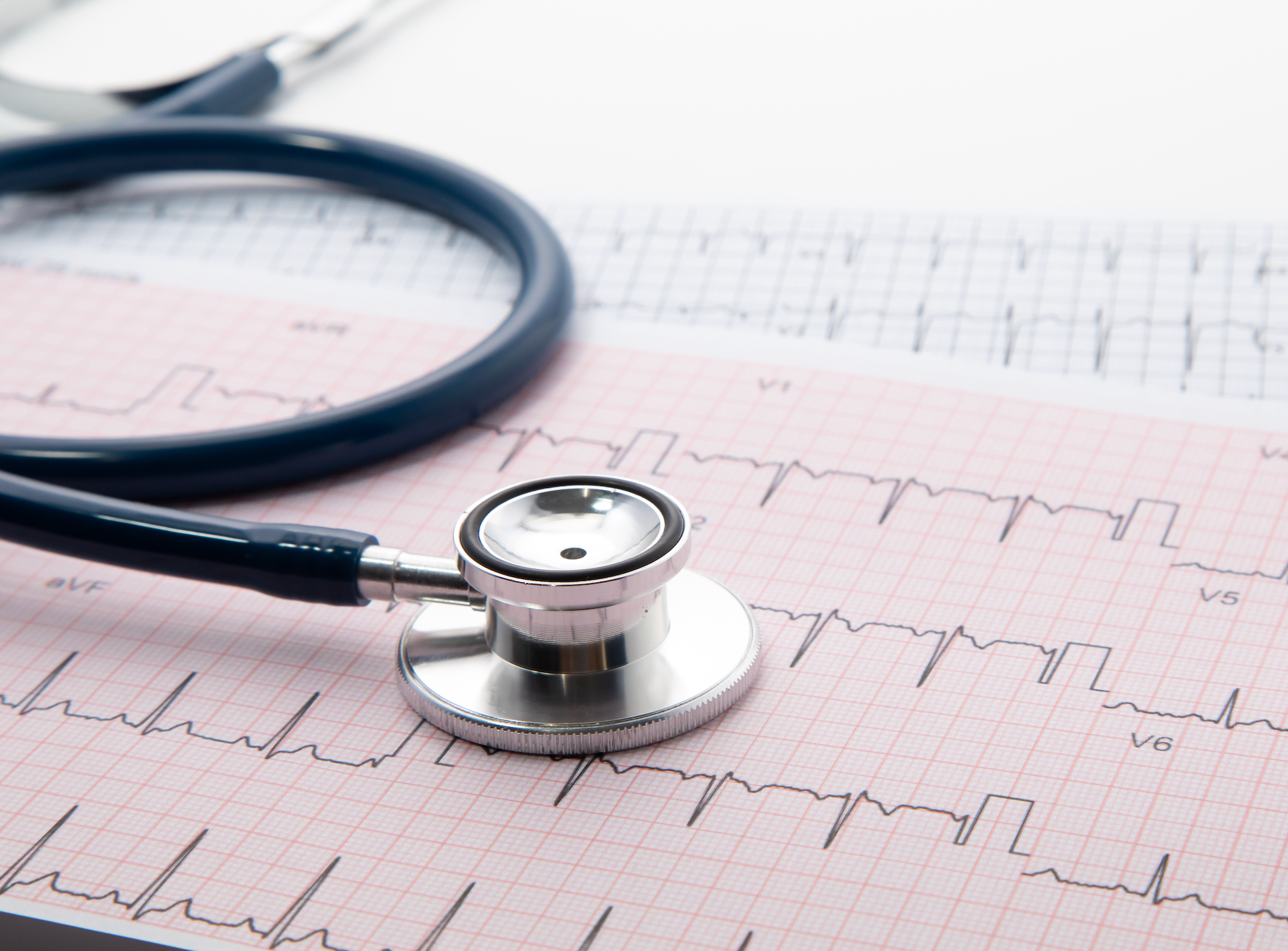 Things to Know When You Are Diagnosed With AFib, With Jennifer Carlquist, PA-C, ER CAQ