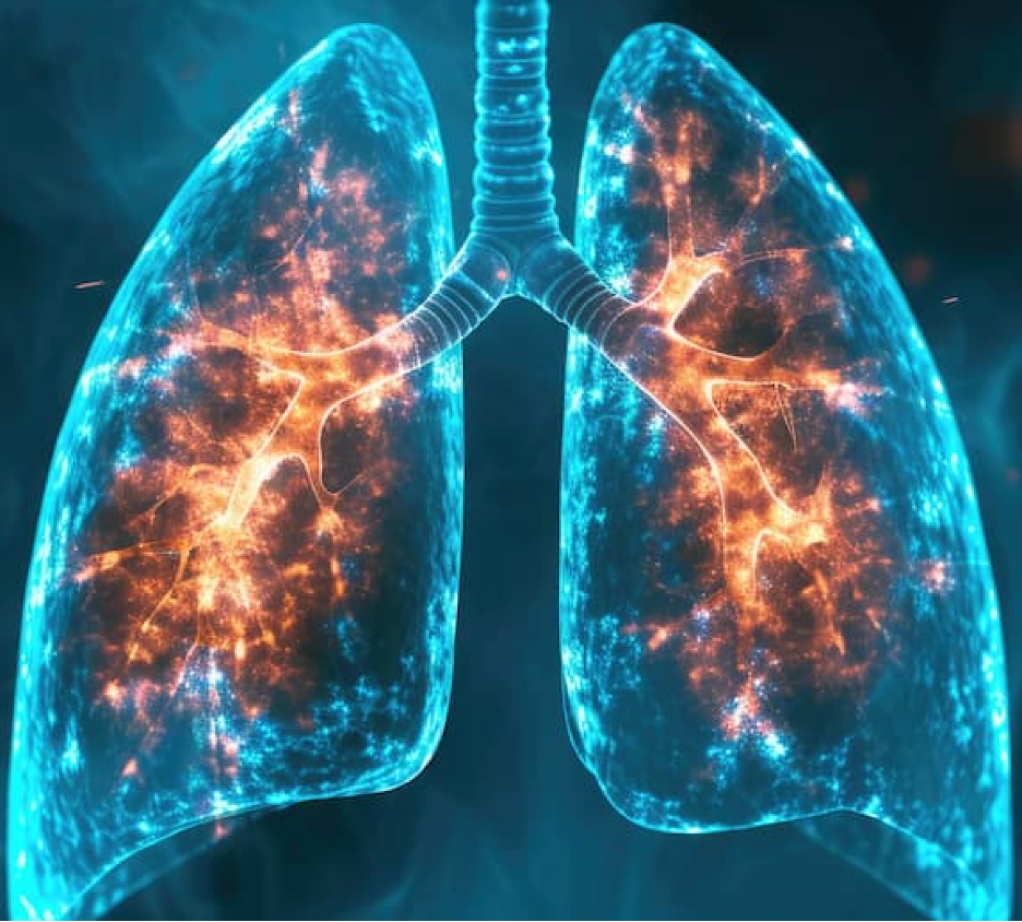 WHO Warns: Tuberculosis Funding Cuts Put Millions at Risk