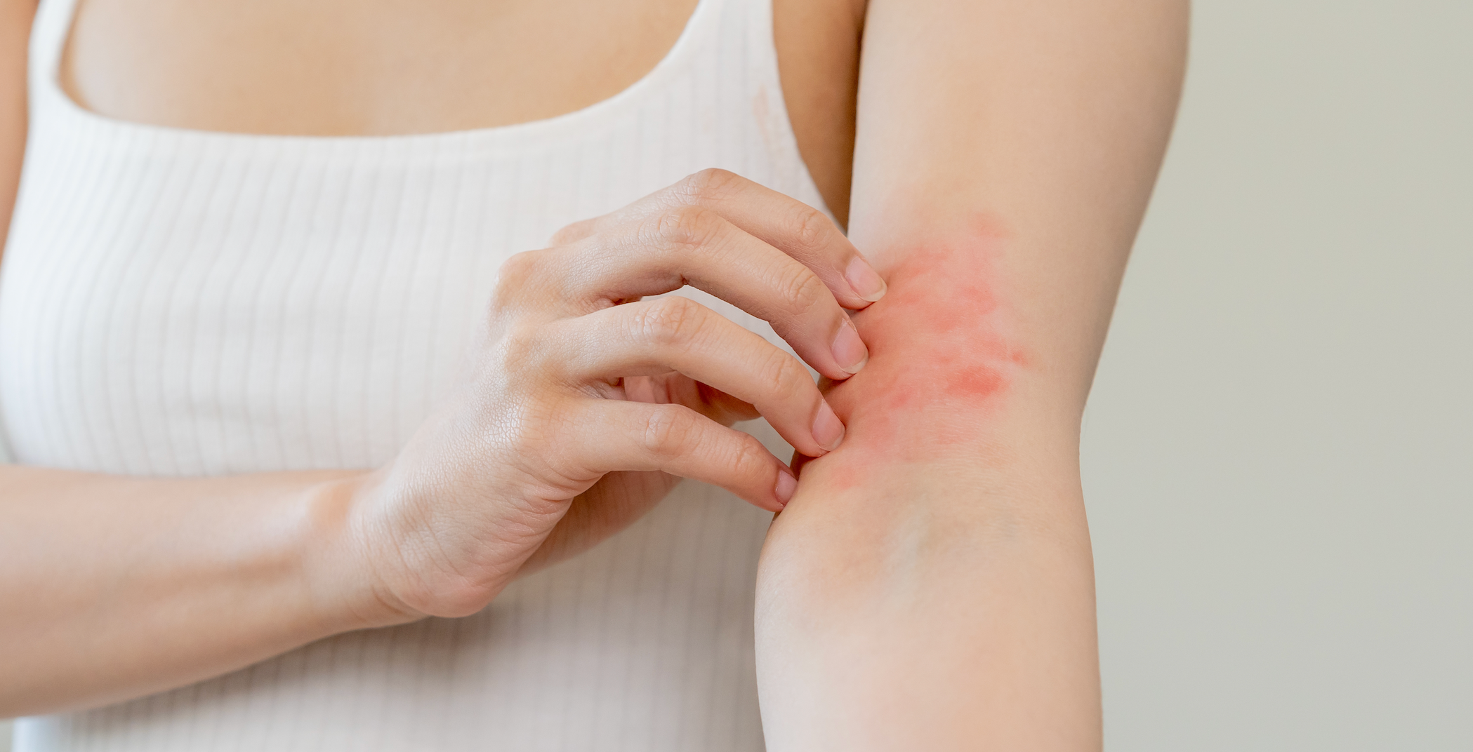 Eczema Doesn't Just Affect Skin, It Disrupts Sleep and Daily Life