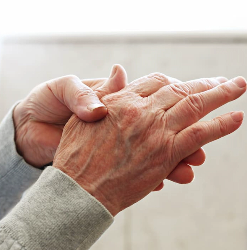 Fibromyalgia, Obesity Linked to Difficult-to-Treat RA