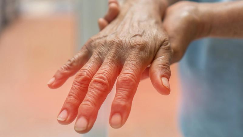 Chronic Inflammatory Demyelinating Polyneuropathy (CIDP)