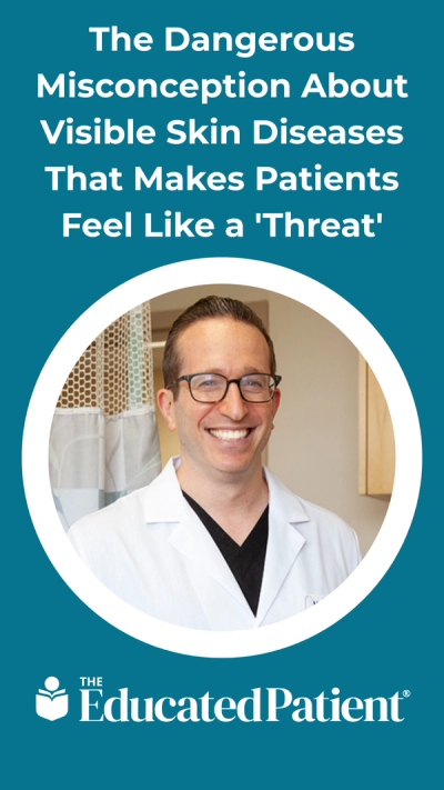 The Dangerous Misconception About Visible Skin Diseases That Makes Patients Feel Like a 'Threat'