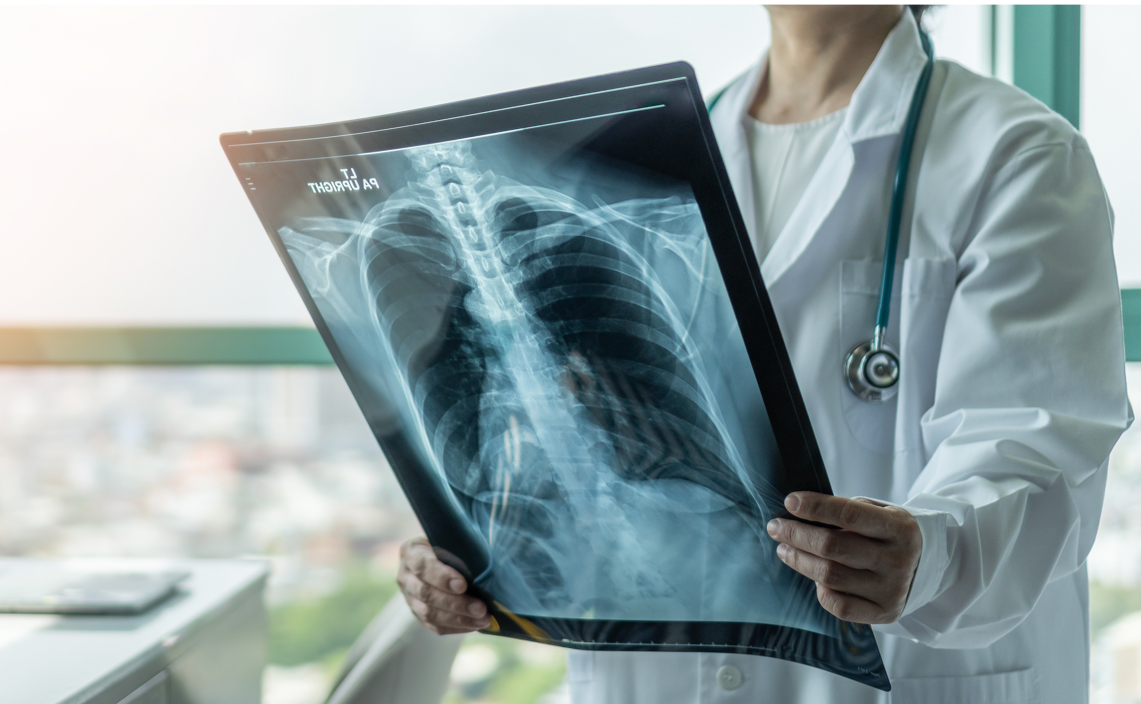 Rare, Misunderstood and Underdiagnosed: The Hard Truth About Pulmonary Hypertension