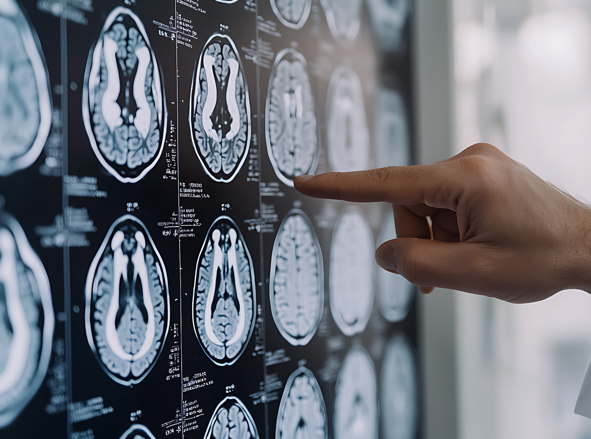 Rewiring the Brain Through Oxygen Therapy, With Shai Efrati, M.D. 