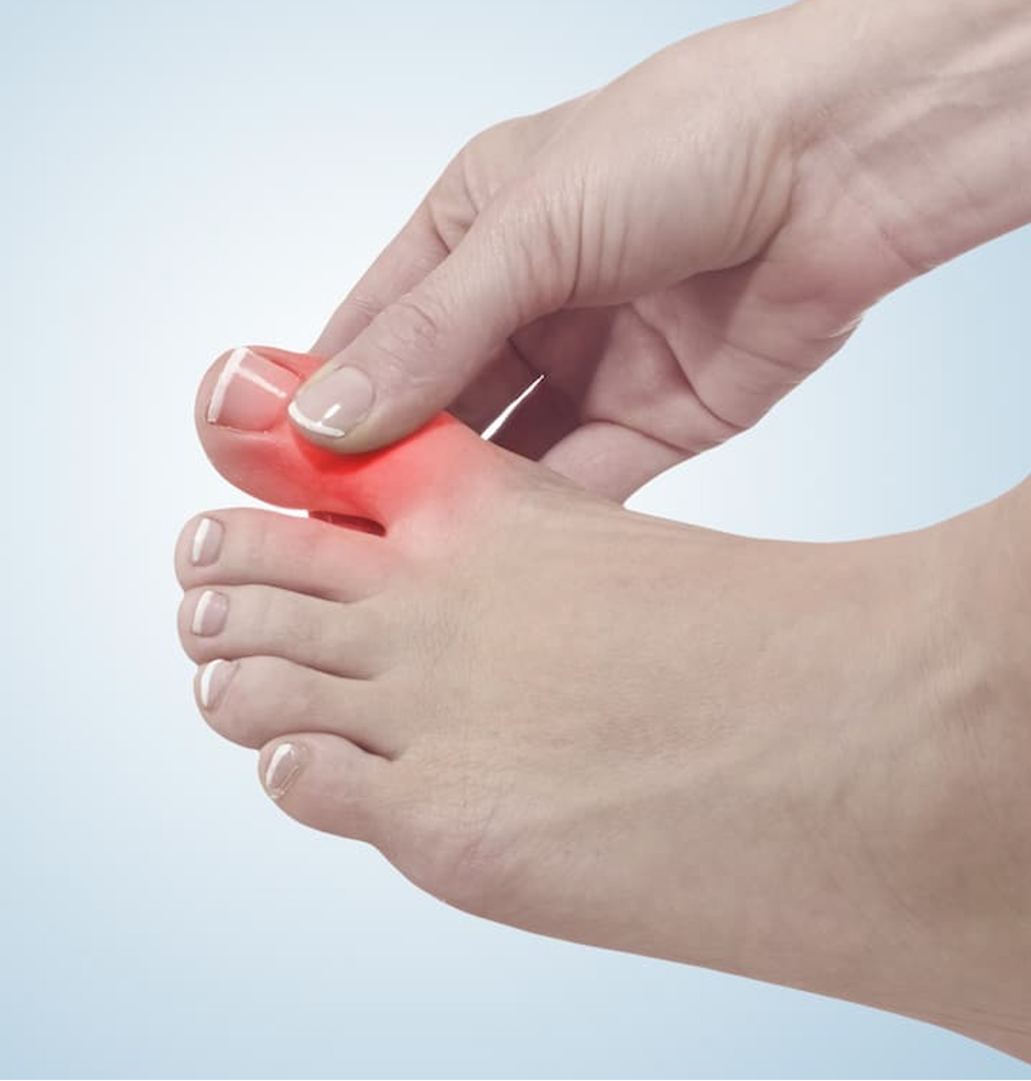 Abdul Abdellatif, MD: Preventing Gout Complications Through Awareness and Early Intervention