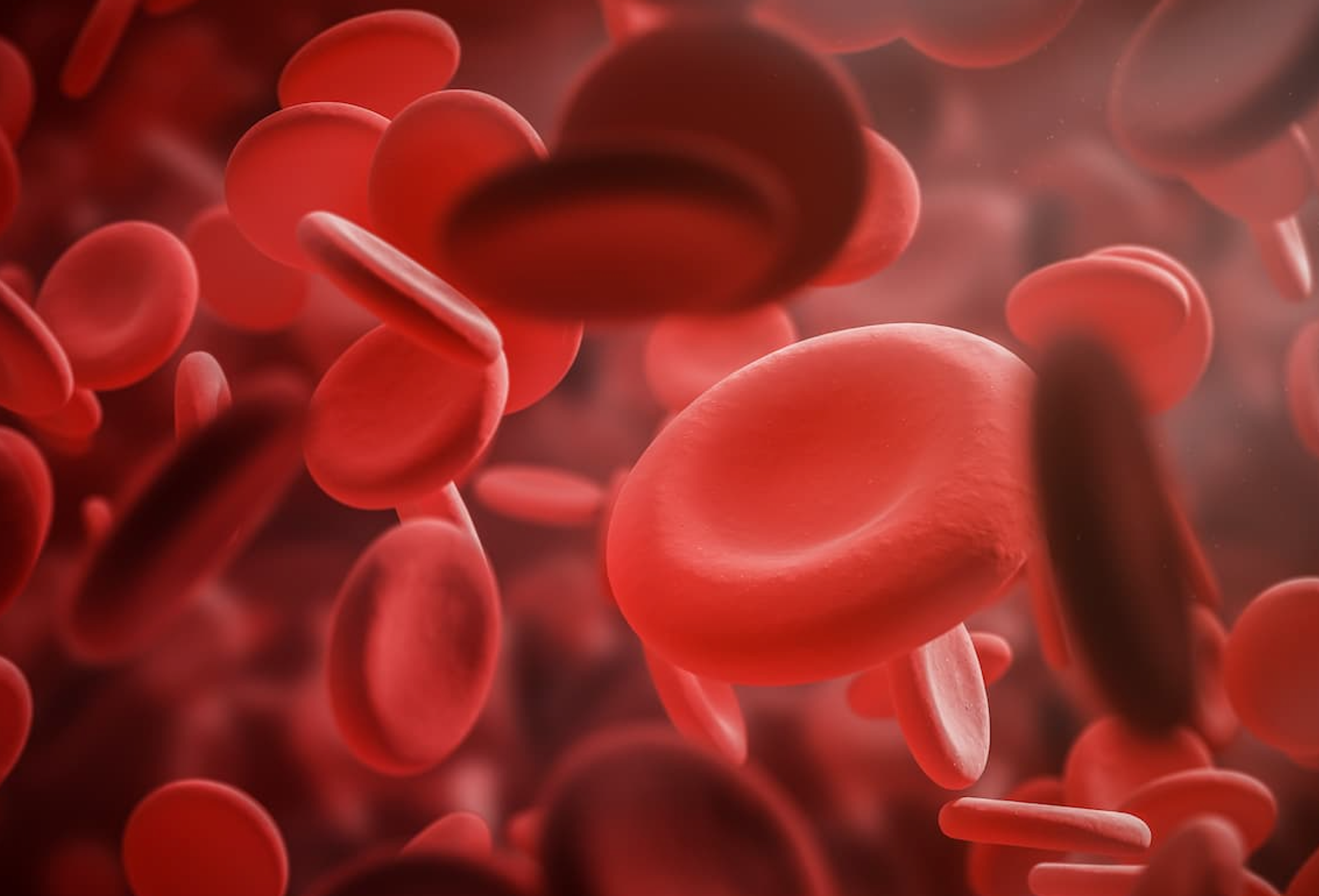 Are Doctors Missing Iron Deficiency in Children?