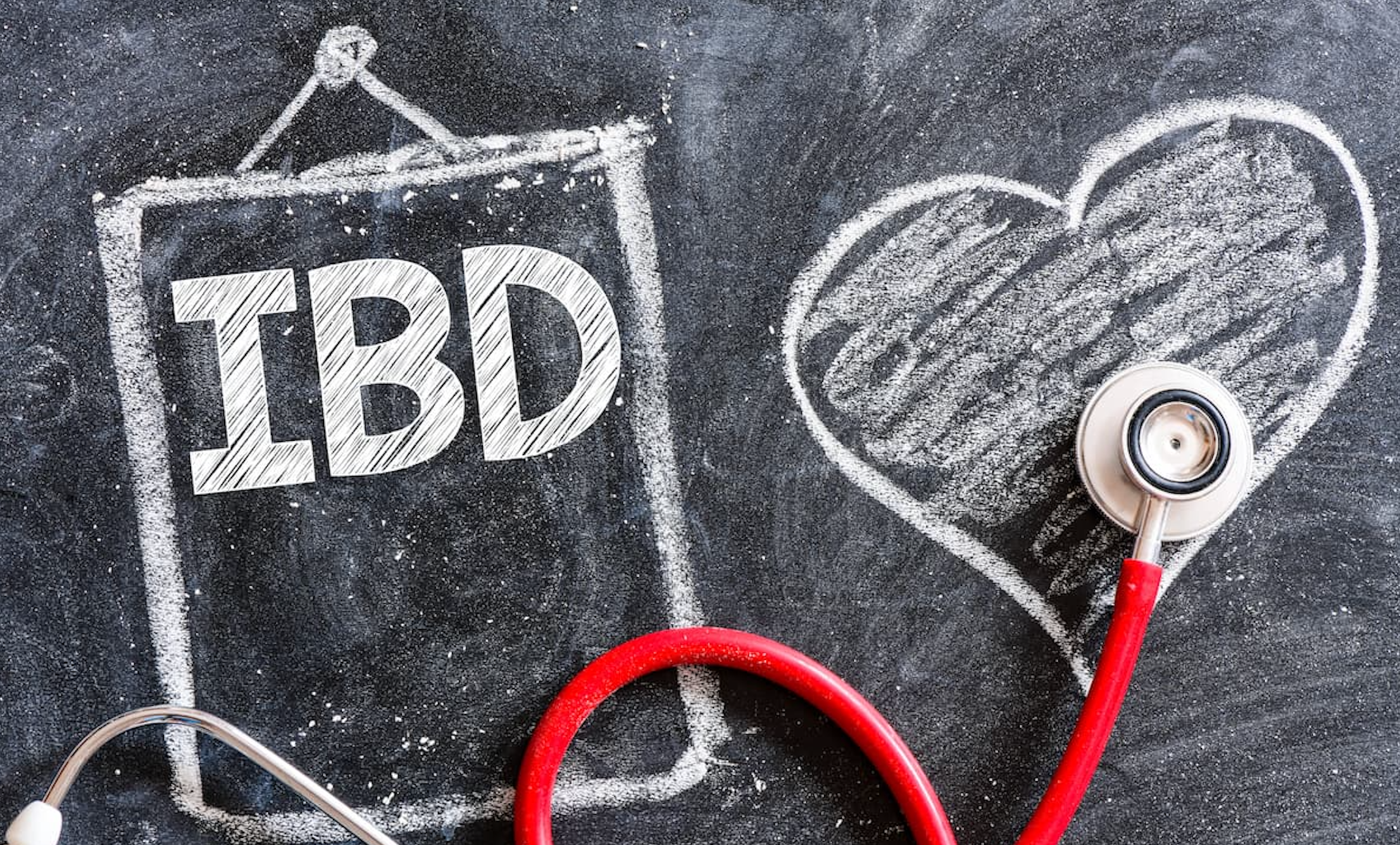 Test Your IBD IQ With This Quick Quiz