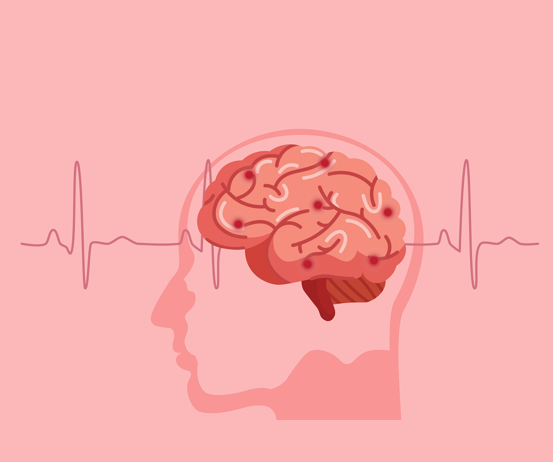 A Stroke at 37: How One Mom’s Health Scare Revealed Severe Heart Failure