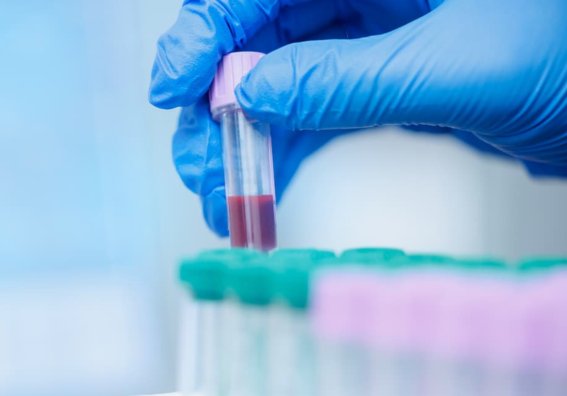 Multi-Cancer Screening Test Expands Access to Early Detection