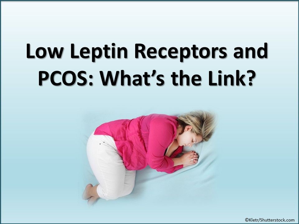 PCOS, polycystic ovary syndrome, obese women, leptin levels, endocrinology