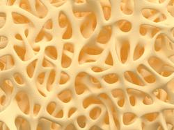 High Levels of Body Fat Linked to Increased Osteoporosis Risk in Men