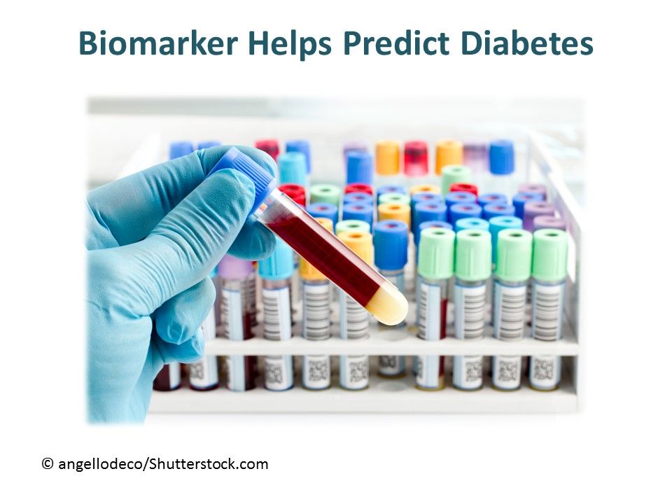 Endo News Roundup Diabetes Biomarker Endocrinology Network
