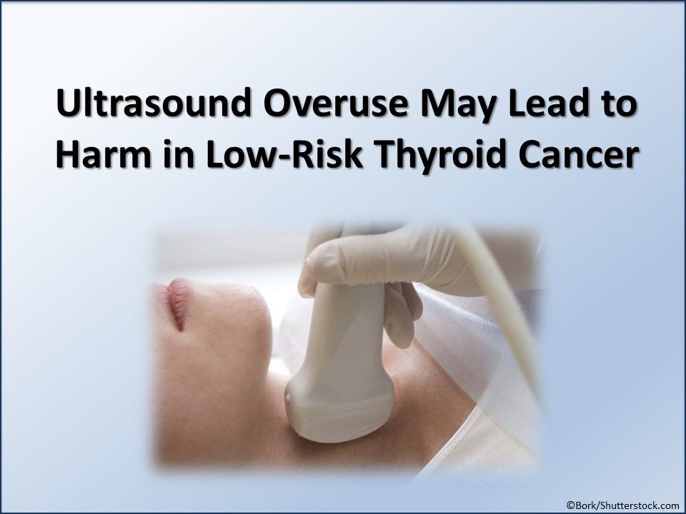 thyroid cancer, ultrasound overuse may lead to harm in low-risk thyroid cancer