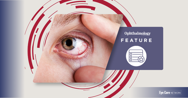 Uveitis: a practical guide for ophthalmologists and optometrists