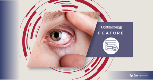 Uveitis: a practical guide for ophthalmologists and optometrists