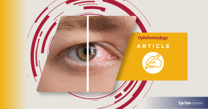 Personalizing dry eye treatment  by addressing disease at its source
