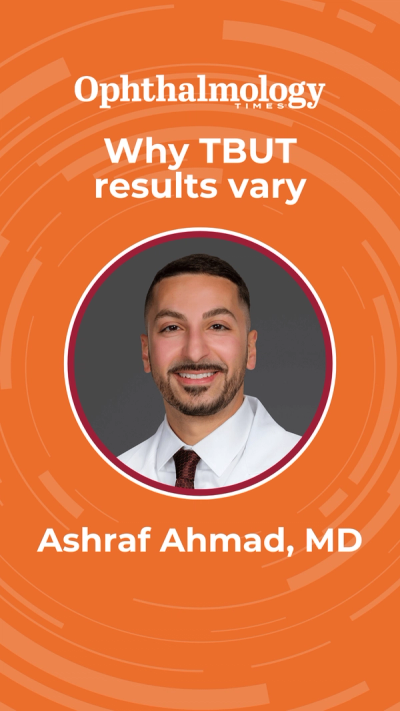 Why TBUT results vary | Ashraf Ahmad, MD | Image Credit: © Ashraf Ahmad, MD - Harvard Eye Associates