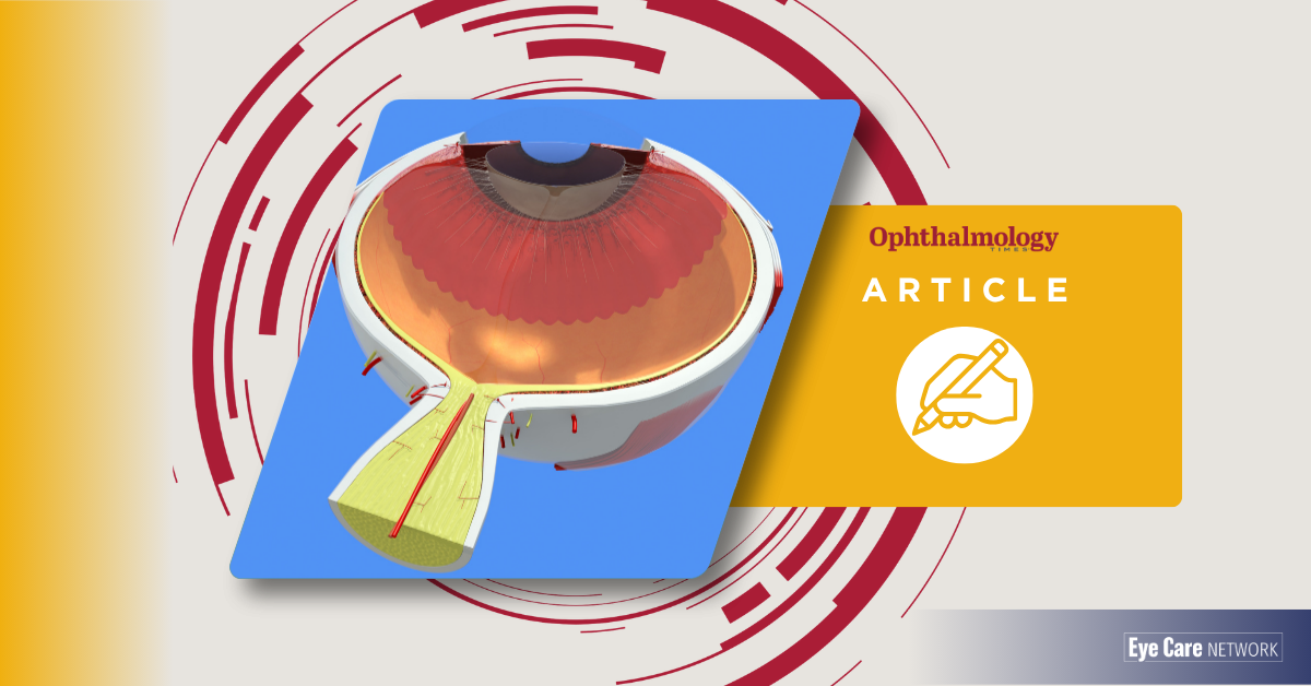 (Ophthalmology Times) Positive 6-month phase 2 results for sustained delivery of K8 in geographic atrophy