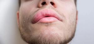 ADVM-053 Receives Orphan Drug Designation for Treatment of Hereditary Angioedema