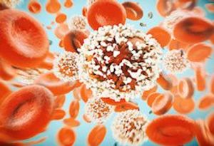 RA Drug May Reduce Toxicity Caused By CAR T Treatment