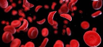 sickle cell disease
