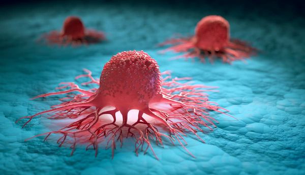 CARsgen’s CAR-T Satri-Cel Significantly Reduces CA19-9 Levels in Patients With Pancreatic Ductal Adenocarcinoma