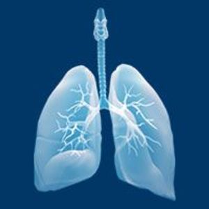 TP53 Mutations Loom Large in Lung Cancer Study